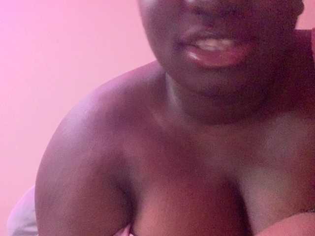  Melaninbratz